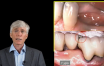 Les facteurs de risques : connexion dent - implant.